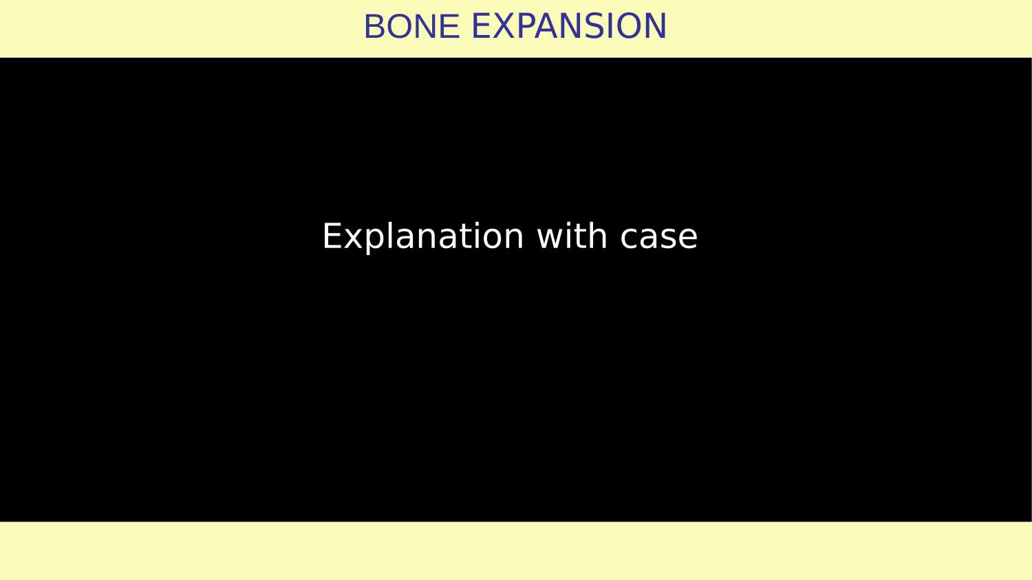 How Osteotomes Should Not Be Used — Part 1 — Slide 14