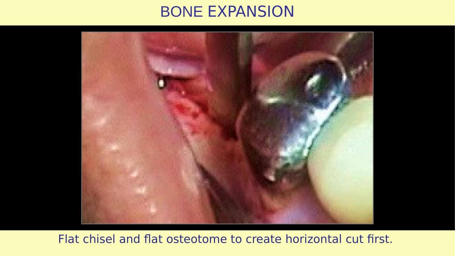 How Osteotomes Should Not Be Used — Part 1 — Slide 18